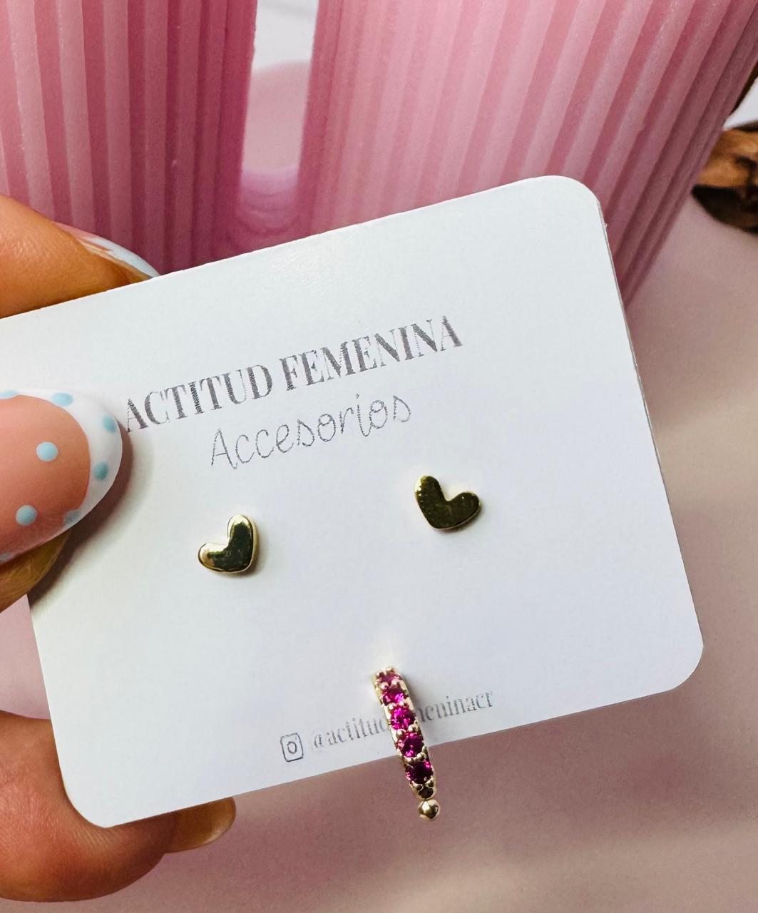 Aretes