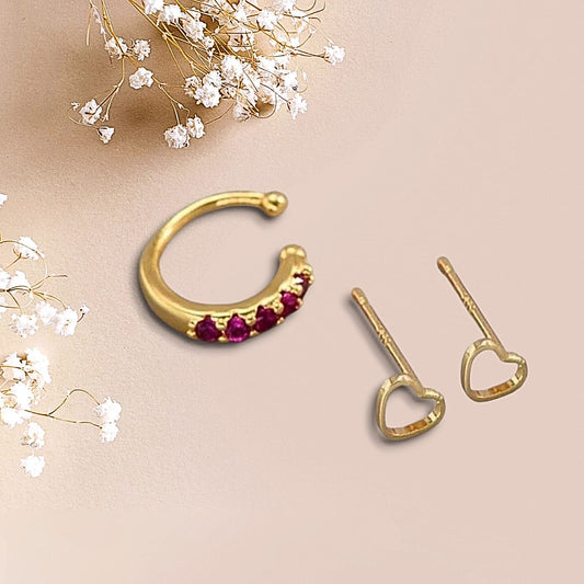 Aretes